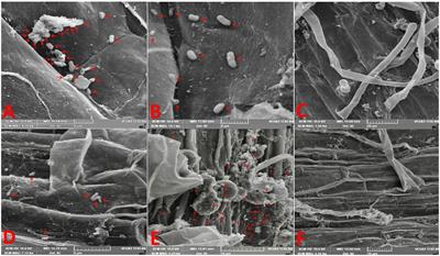 Understanding plant–microbe interaction of rice and soybean with two contrasting diazotrophic bacteria through comparative transcriptome analysis